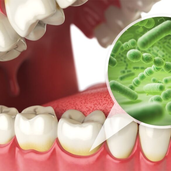 Oral Health and Bacterial Growth